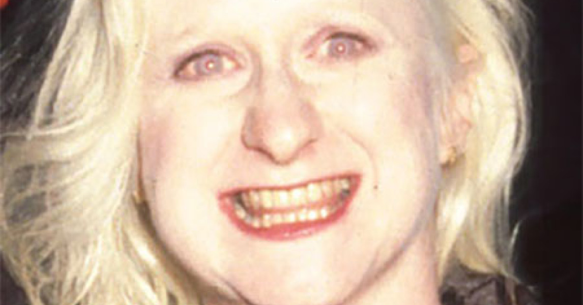 Hatchet Face Actress 60 Photos - Moonagedaydream.film